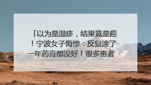 以为是湿疹，结果竟是癌！宁波女子悔惨：反复涂了一年药膏都没好！很多患者首诊都去了皮肤科