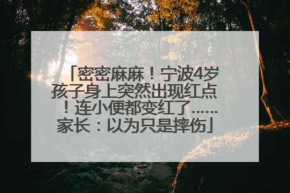 密密麻麻！宁波4岁孩子身上突然出现红点！连小便都变红了……家长：以为只是摔伤